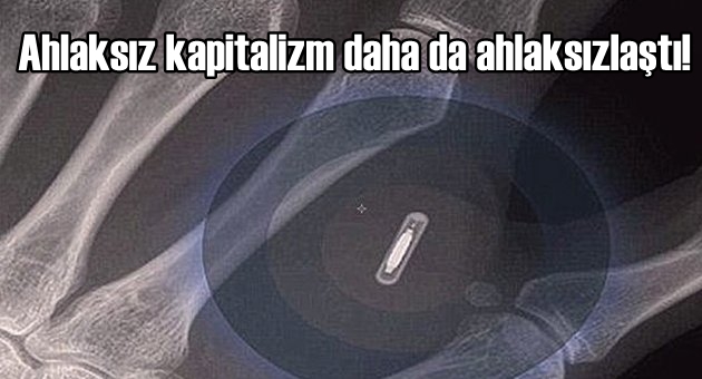 İsveç’te çalışanlara çip takıldı