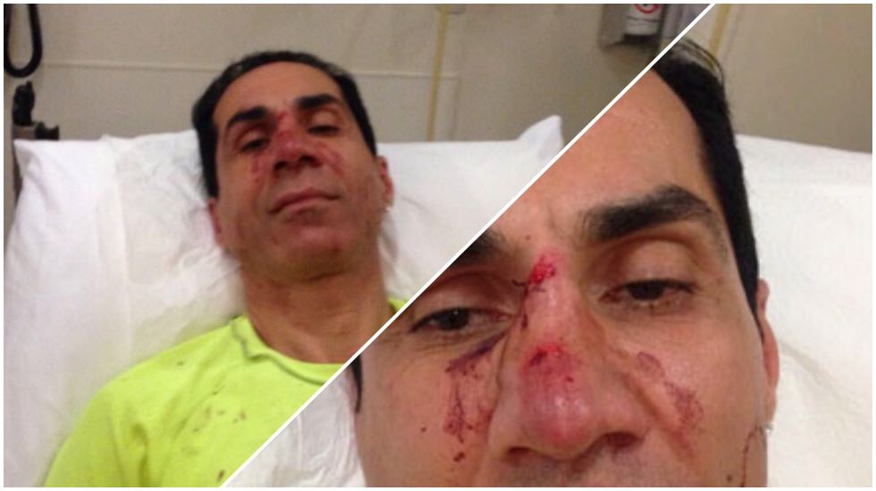 CHP’li meclis üyesine hain saldırı