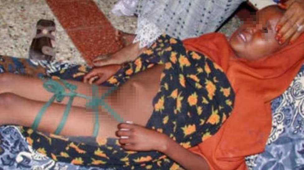 Dünyada kadın sünnetinin önüne geçilemiyor