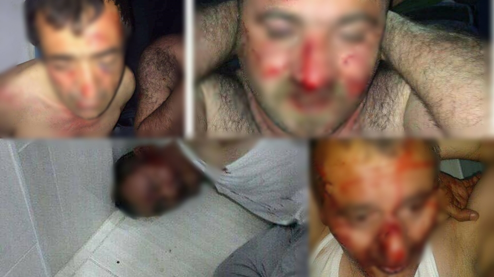 AKP milletvekili o görüntülere karşı çıktı: İnsanlık namına şiddetle kınıyorum