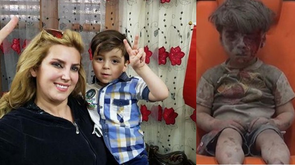 Cihatçıların propaganda malzemesi yaptığı Ümran bebek Halep’te ailesiyle yaşıyor