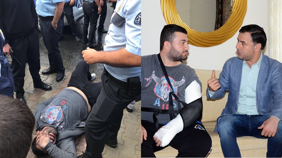 Polis CHP’li gencin kolunu kırdı; AKP’lilere biber gazı sıktı