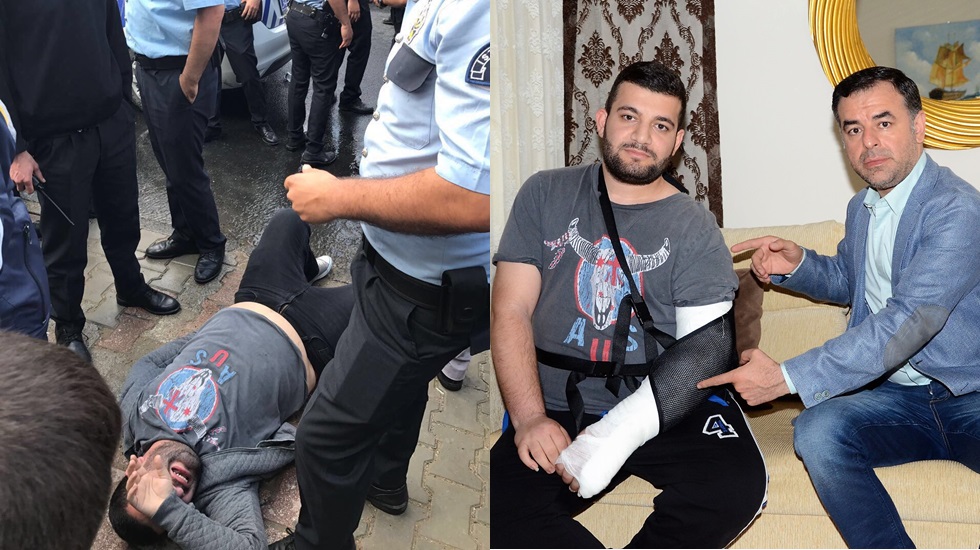 ‘Kol kırmak serbest, hesap sormak ise yasak’