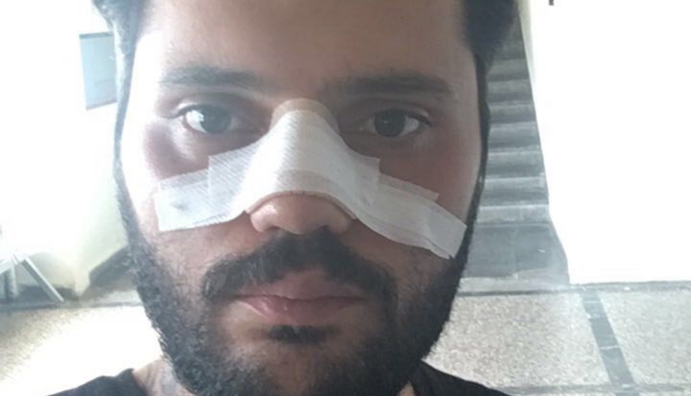 Yarkadaş’tan ‘Özel Güvenlik Terörüne’ tepki