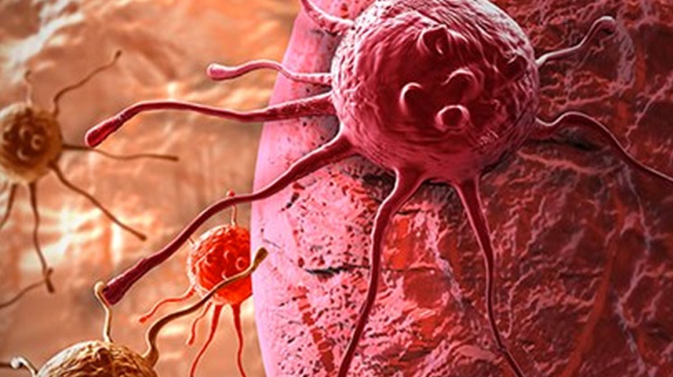 Kanser artık romatoid artrit gibi kronik bir hastalık olma yolunda…