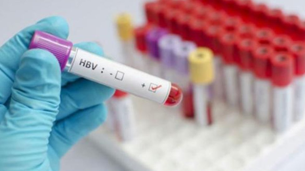 3 binden fazla hastaya HIV veya hepatit bulaşmış olabilir