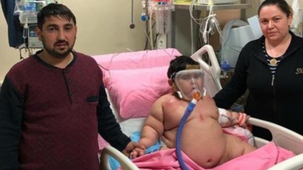3 buçuk yaşındaki Yağız bebek 55 kiloya ulaştı