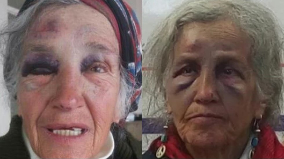 75 yaşındaki kadını darp eden polise ödül gibi ceza