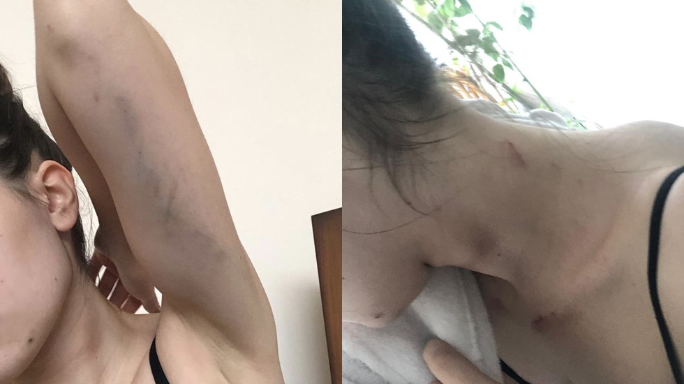 https://yenisoluk.com/uploads/2019/02/siddet22