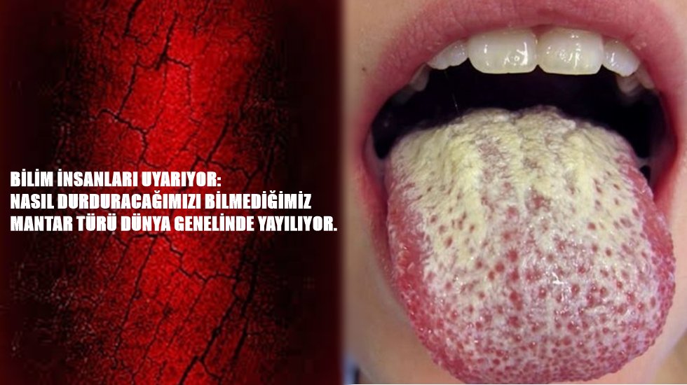 Öldüren mantar yayılıyor