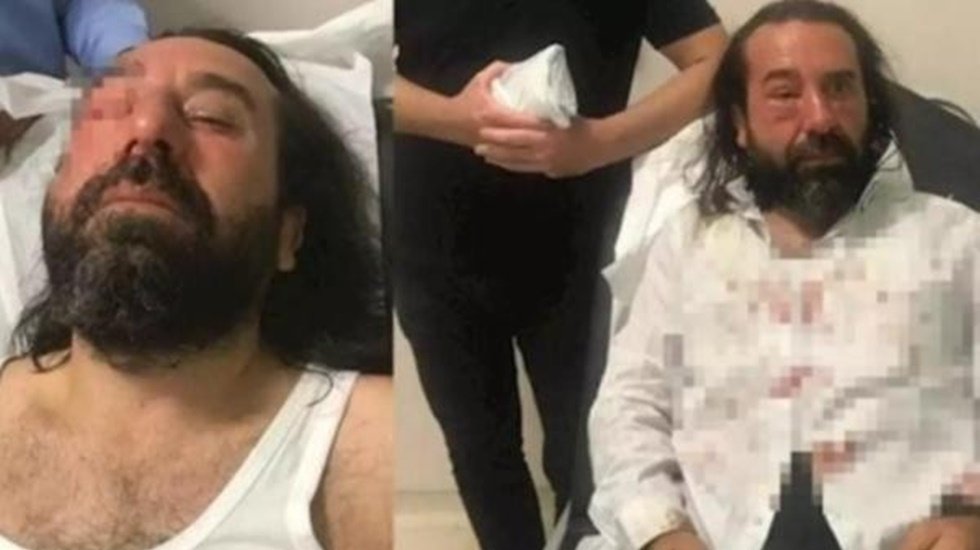 Saldırıya uğrayan İYİ Partili Bozkurt'tan ilk a&ccedil;ıklama