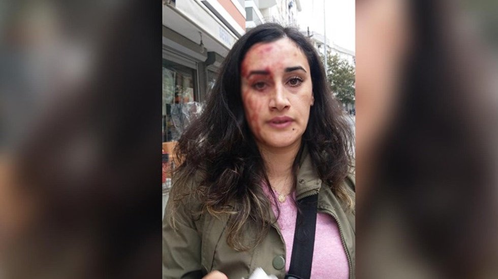 Patron ter&ouml;r&uuml;: Tazminatsız işten attığı kadın iş&ccedil;inin başını yardı