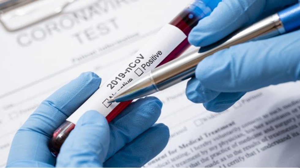T&uuml;rkiye Kolombiya'ya 26 bin Koronavir&uuml;s tanı testi g&ouml;nderdi