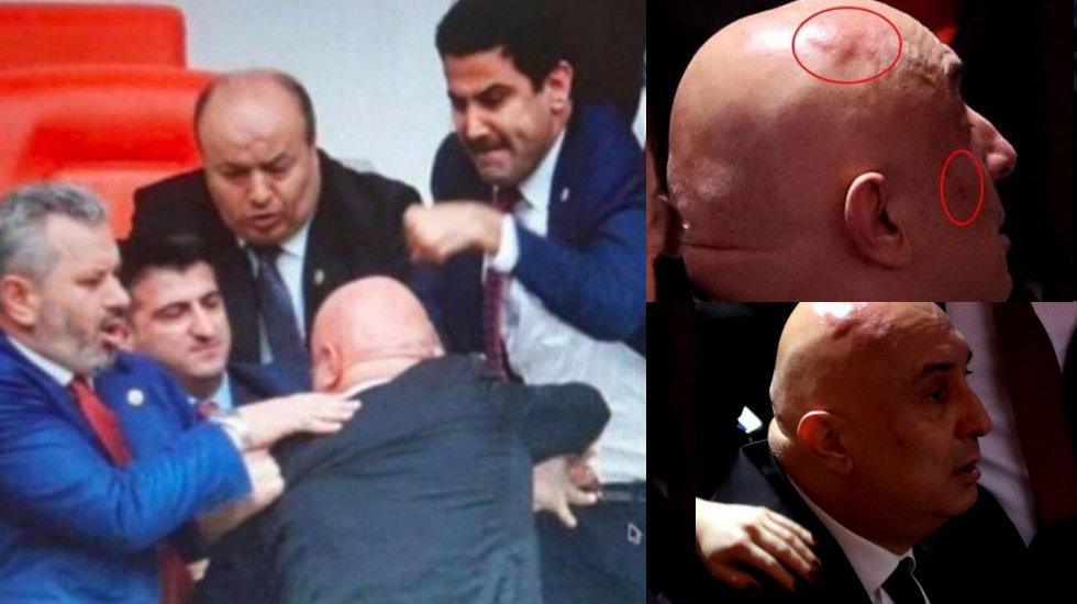 AKP'li vekilden skandal Engin &Ouml;zko&ccedil; s&ouml;zleri: O al&ccedil;ağın bir yerlerinin kırılması lazımdı!
