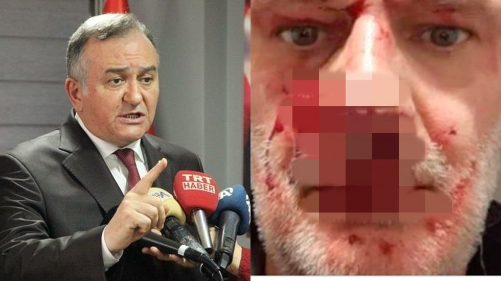 MHP Grup Başkanvekili Ak&ccedil;ay, lin&ccedil; girişimini fotoğrafla kutladı!