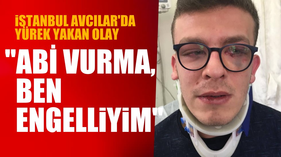 Otizmli genci darp etti, serbest bırakıldı!