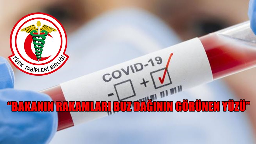 TTB&rsquo;den &uuml;rk&uuml;ten a&ccedil;ıklama!