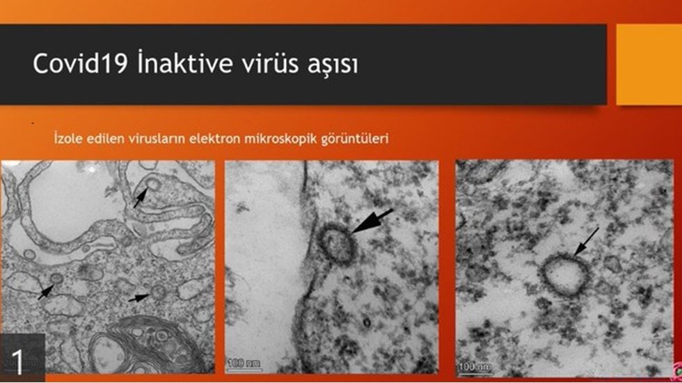 Prof. Dr. Ovalı vir&uuml;s&uuml; etkisiz hale getirdiği g&ouml;r&uuml;nt&uuml;y&uuml; paylaştı