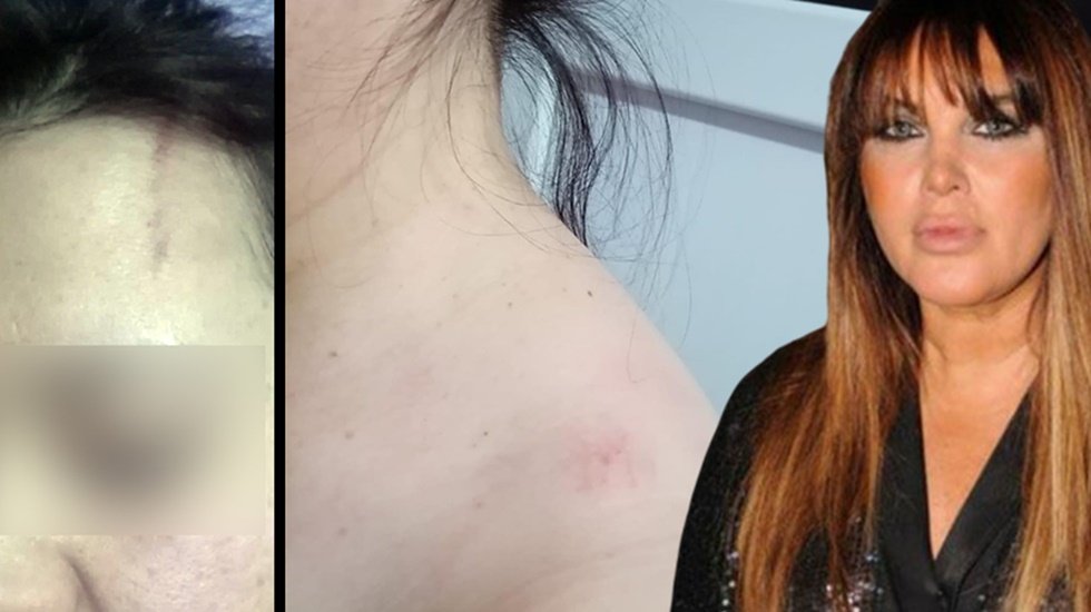 Seren Serengil &Ouml;zbek yardımcısını darp etti, mağdurun şikayeti kabul edilmedi