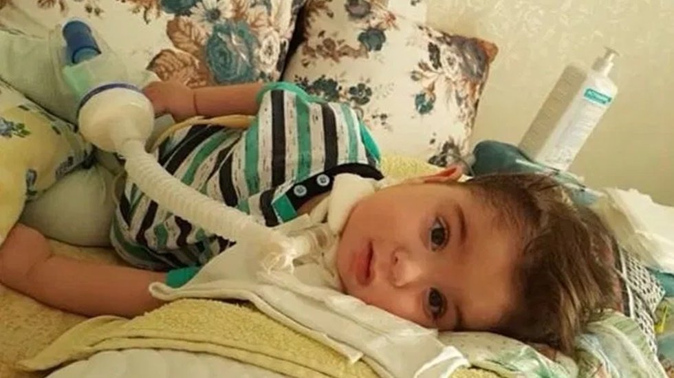 3 binden fazla SMA hastası ve aileleri perişan!