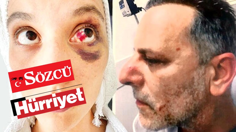 H&uuml;rriyet ile S&ouml;zc&uuml; arasında haber &ccedil;alma kavgası b&uuml;y&uuml;yor