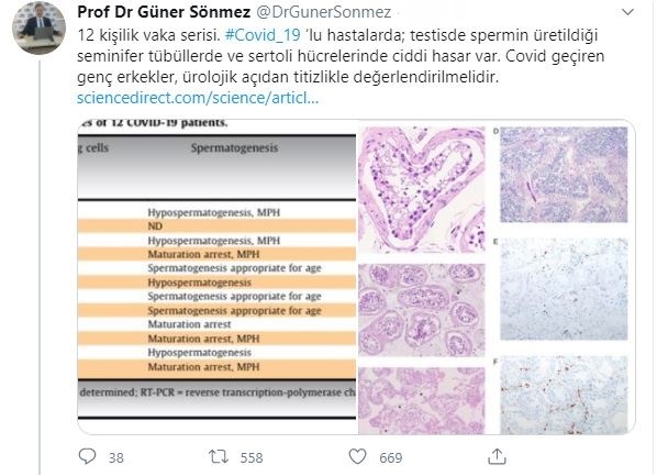 https://yenisoluk.com/uploads/2020/08/prof-dr-guner-sonmez-001