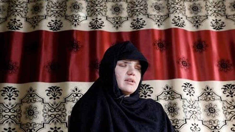 İnsanı dehşete d&uuml;ş&uuml;ren olay! &Ccedil;alışıyor diye vurulup g&ouml;zlerinden bı&ccedil;aklandı