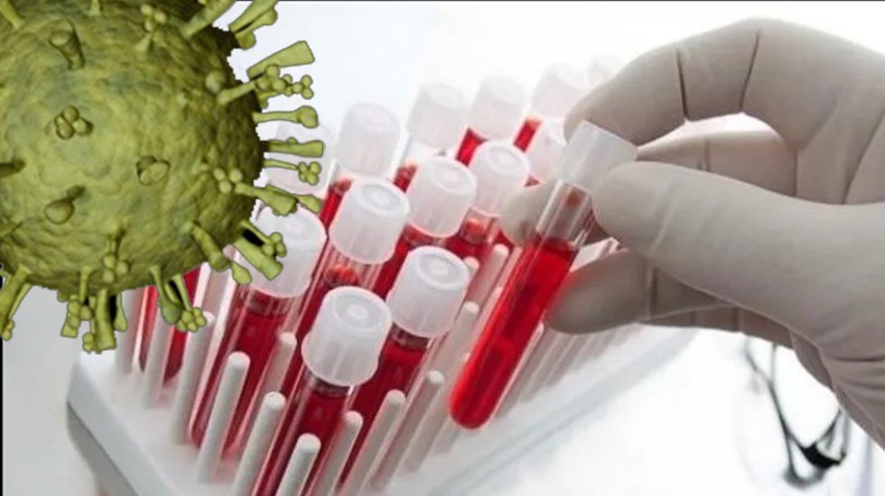 100 bin kişiye sahte PCR testi satıldı iddiası