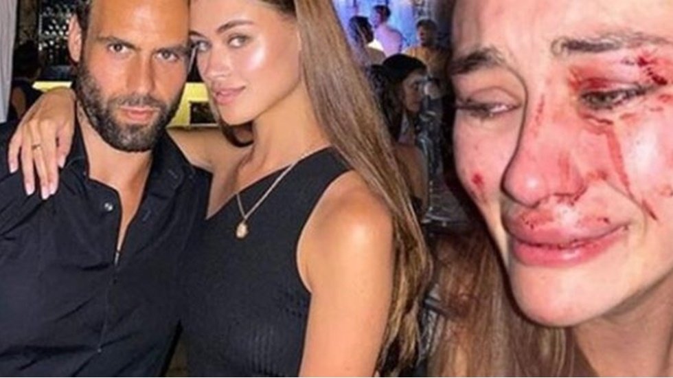 Yediği dayakla gündeme gelen top modelden şok karar!