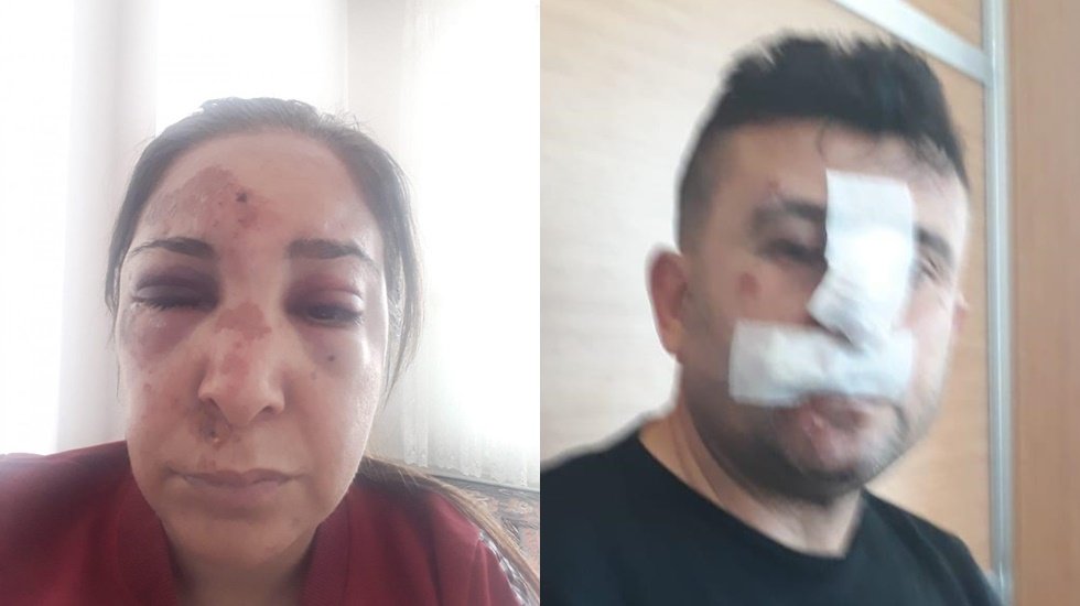 Gazeteci Yarkadaş&rsquo;tan Polis şiddeti iddiası...