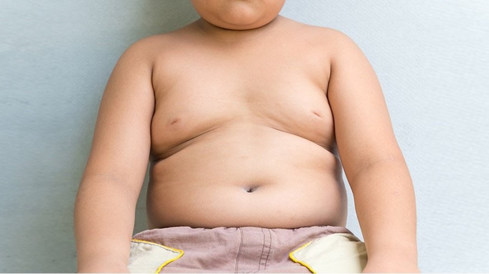 Çocukluk çağı obezitesi ihmal edilmemeli