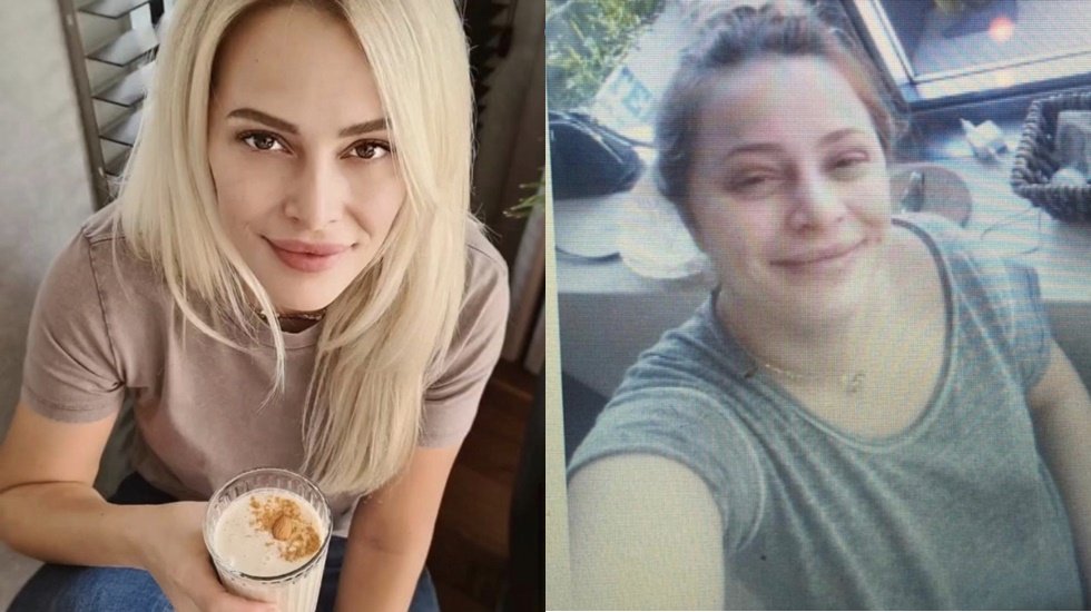 Verdiği kilolarla başkalarına umut oluyor