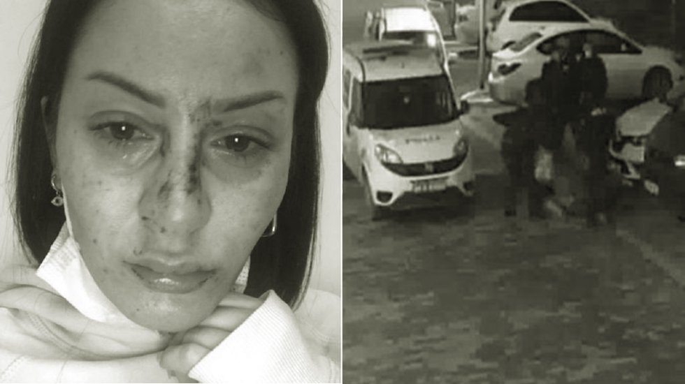 CHP&rsquo;li Vekil polisin sokak ortasında d&ouml;vd&uuml;ğ&uuml; kadını Bakan Soyluya sordu
