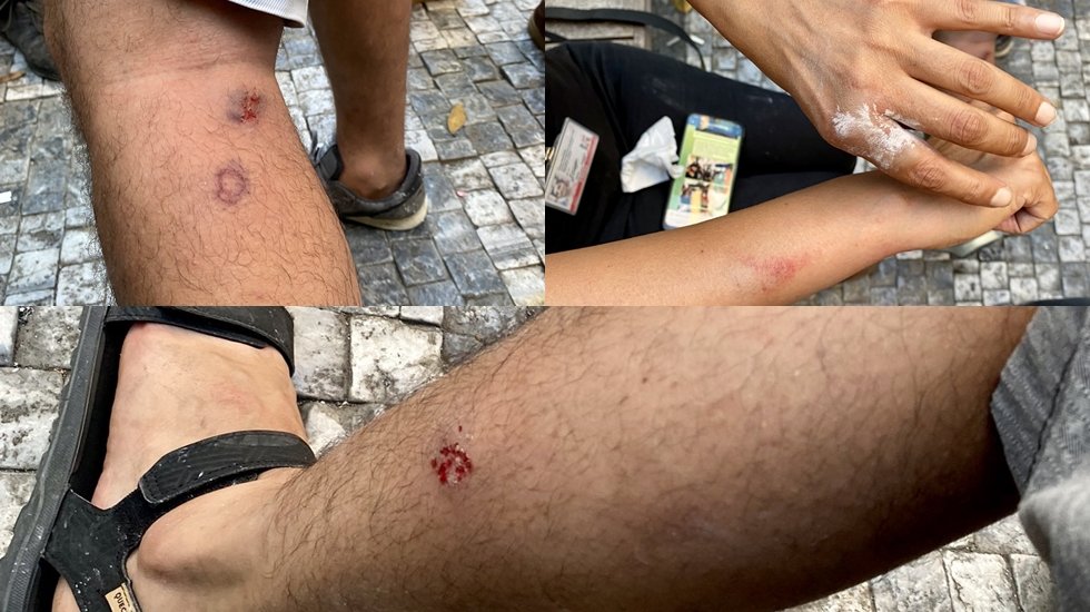 Suru&ccedil; anmasında polisin basına y&ouml;nelik plastik mermili m&uuml;dahalesine tepki