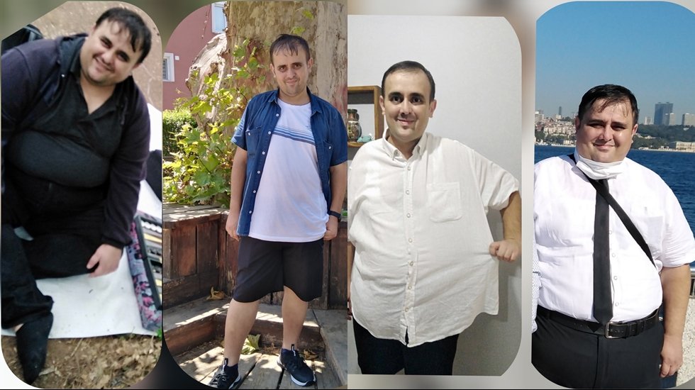 57 kilo verdi, 10 yaş birden gençleşti