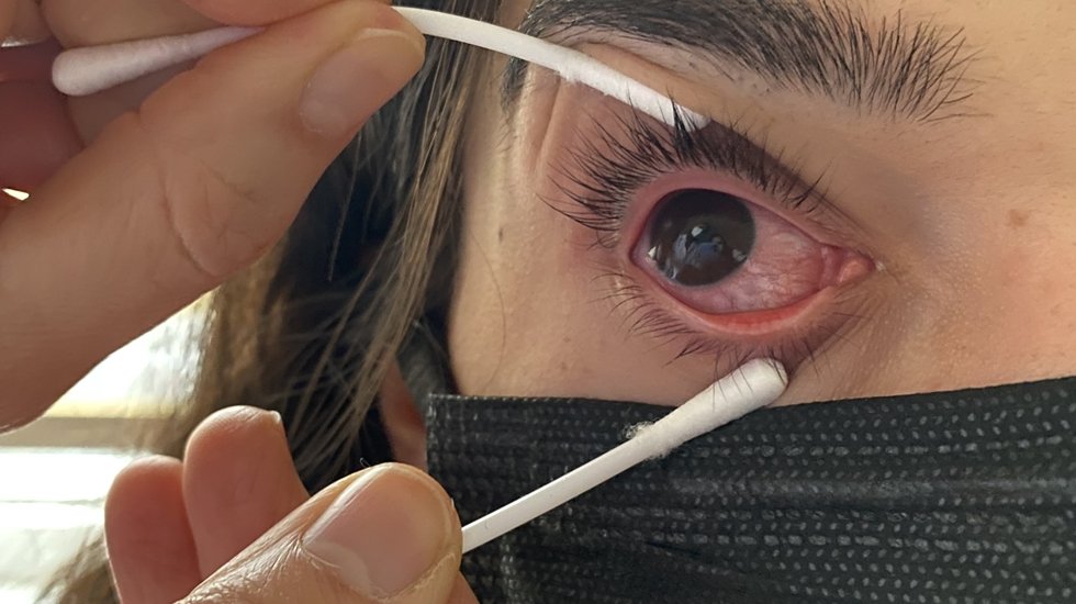 Diyabet, ciddi görme kayıplarına neden oluyor