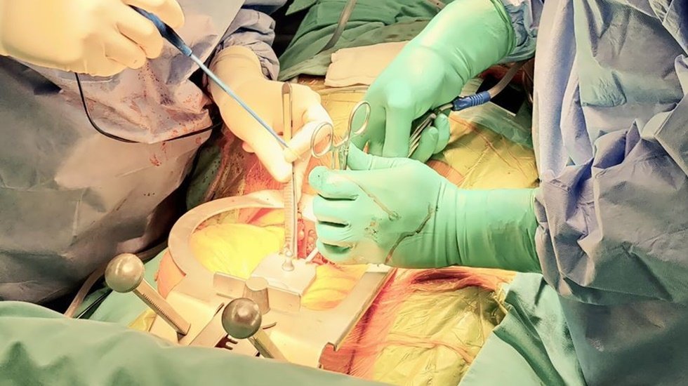 Kahire Üniversitesi’nin Cerrahları Mini By-Pass’ı Türkiye’de Öğrendi 
