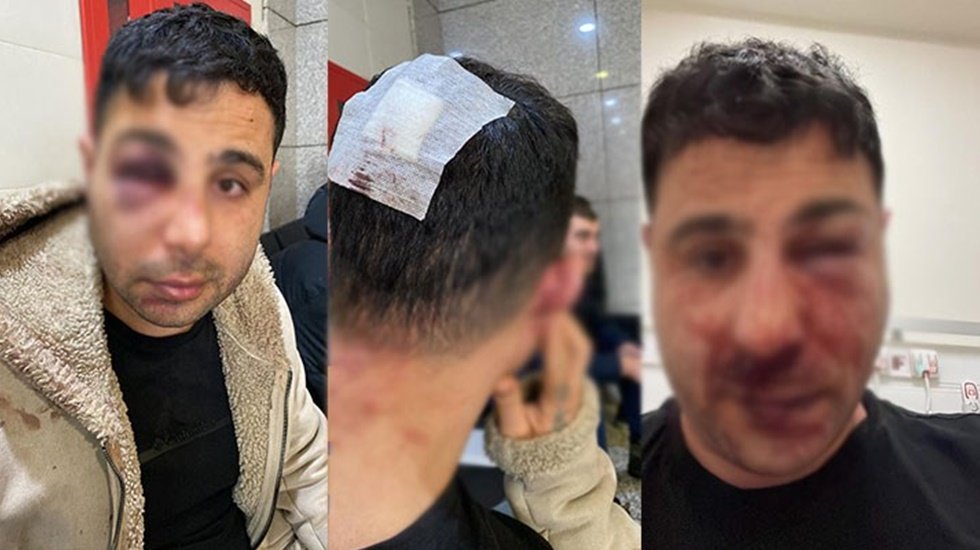 Polis aracında feci dayak