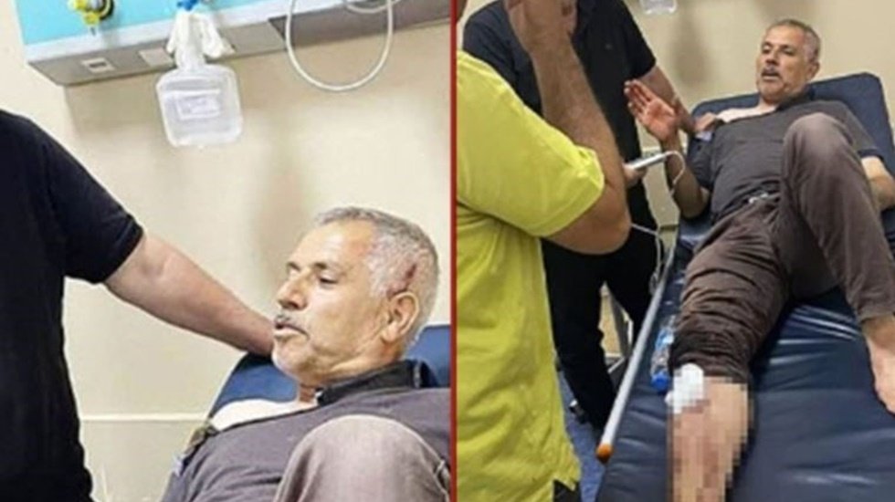 AKP'den istifa eden meclis &uuml;yesini maskeli bir grup darp etti