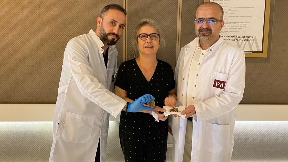 Bel ağrısı şikâyetiyle gitti  böbreğinde 15 santim taş çıktı…
