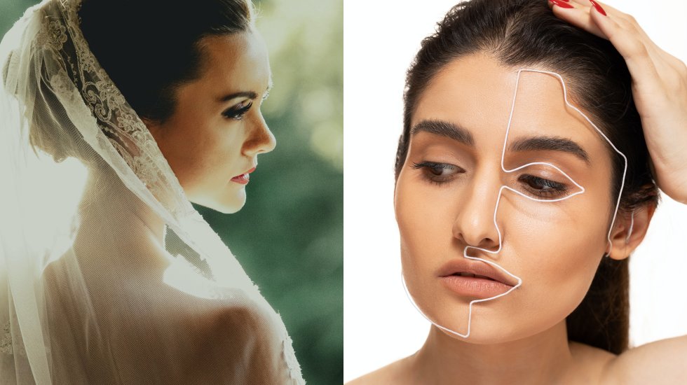 Estetik operasyonda "düğün" telaşı! Jawline ve burun dolgusuna talep arttı