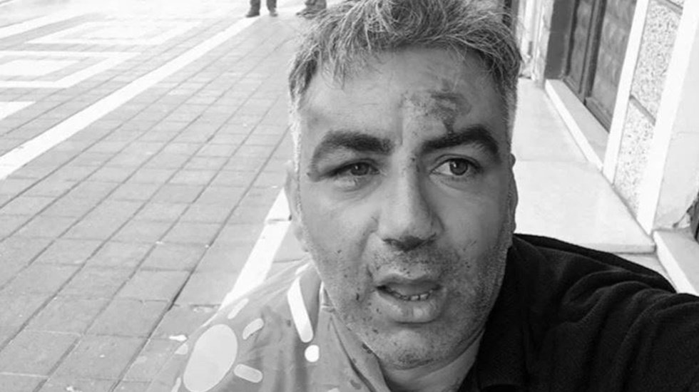 İYİ Partililere saldıranların MHP Esenyurt il&ccedil;e y&ouml;neticileri olduğu ortaya &ccedil;ıktı...
