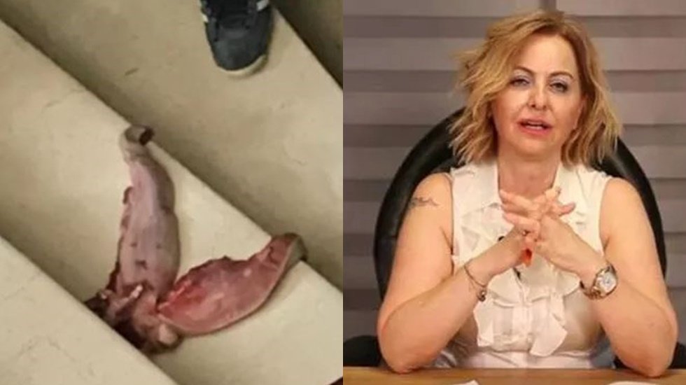 Prof. Dr. Şenol&rsquo;u tehdit eden şahsın sahte doktor olduğu teyit edildi