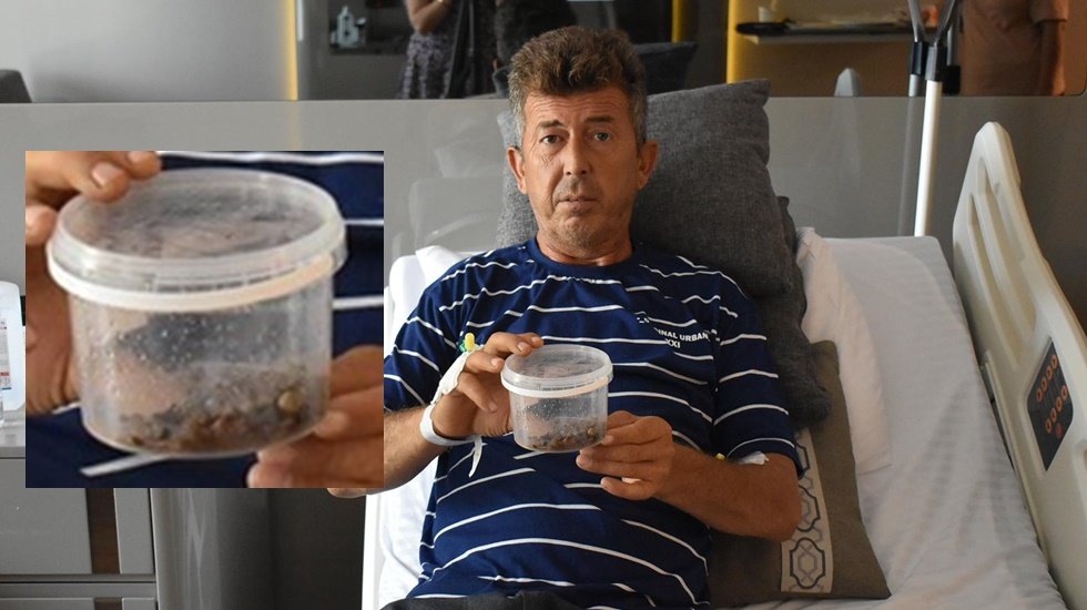 Tek operasyonda tüm böbreğini dolduran bir kutu taştan kurtuldu!