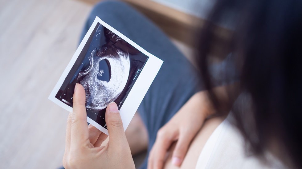Akrabalık düzeyi ne kadar yakınsa fetal sakatlık riski o kadar artıyor