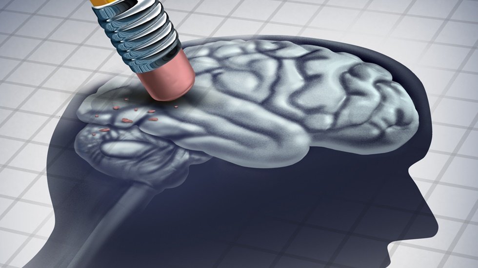 Alzheimer’ın erken dönem belirtilerine dikkat! Sinsi bellek kaybı ile başlıyor!
