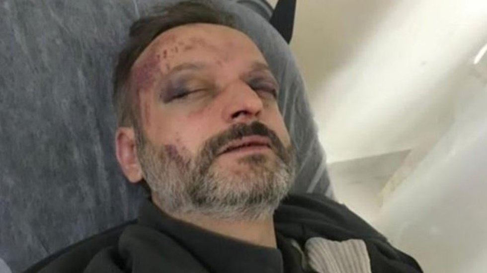 CHP'li Ağbaba'dan 'istek par&ccedil;a' dehşetine sert tepki: Yeni bir maganda t&uuml;r&uuml; ortaya &ccedil;ıktı...