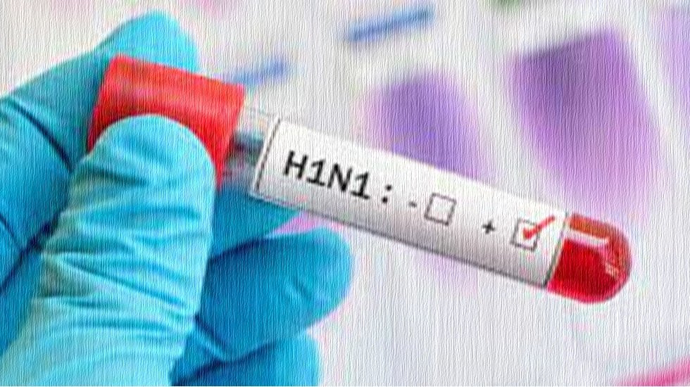 H1N1 Virüsü Nedir? Nasıl Bulaşır?