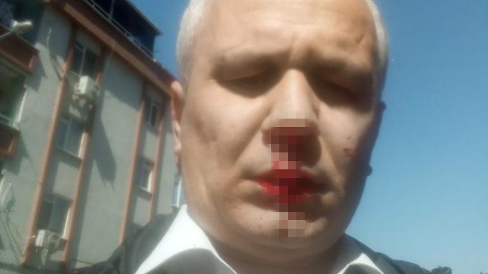 İlahiyat&ccedil;ı yazar Cemil Kılı&ccedil;'a tekbirli sopalı saldırı