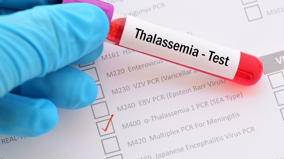 Talasemide enfeksiyona bağlı yaşam kayıplarına karşı önlem alınmalı